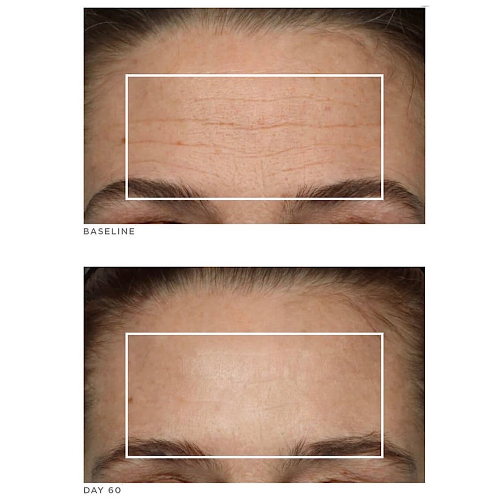 NUFACE TRINITY COMPLETE FACIAL TONING KIT - Picture 11 of 12